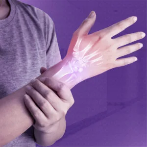 تحاليل الروماتيزم وآلام المفاصل