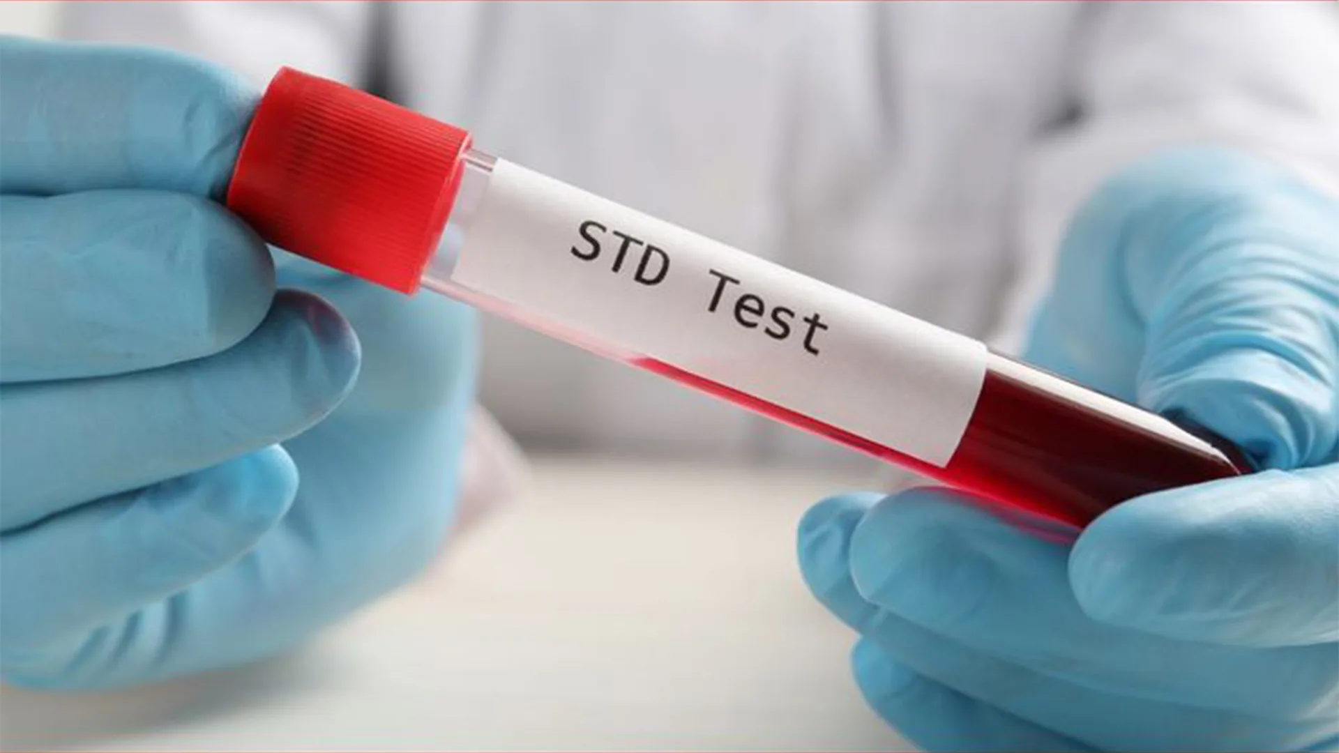 تحليل std في إسطنبول