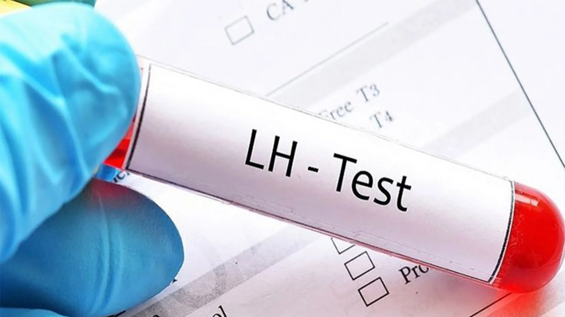 اختبار هرمون LH في إسطنبول.