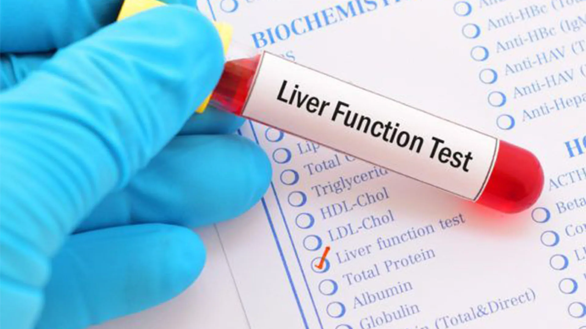 وظائف الكبد في إسطنبول بدقة عالية.