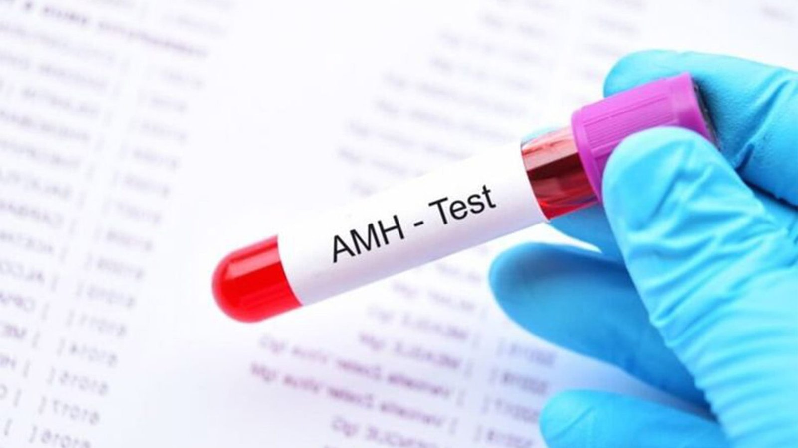 فحص هرمون AMH في إسطنبول بدقة عالية.