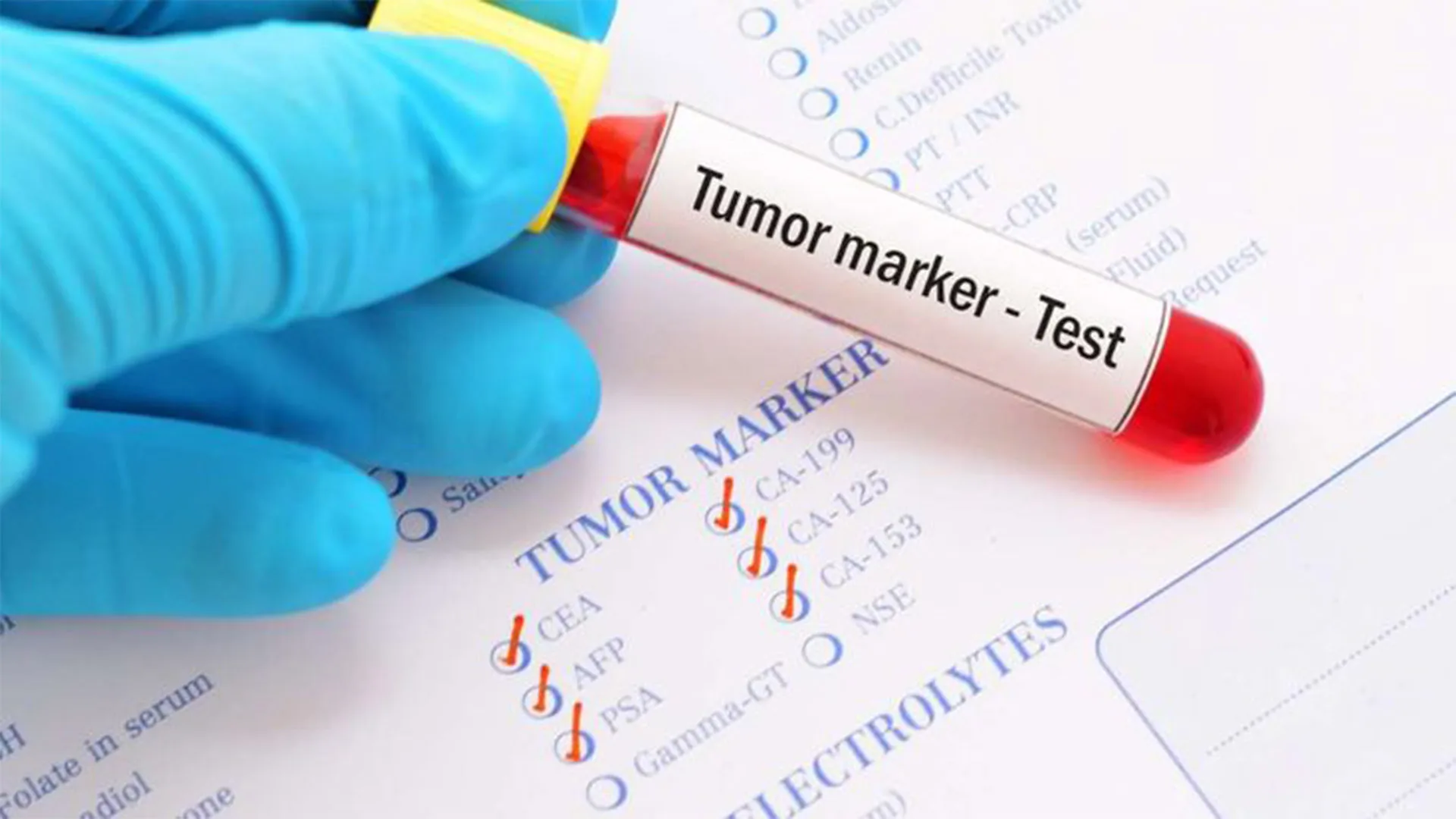 تحاليل المؤشرات السرطانية في إسطنبول