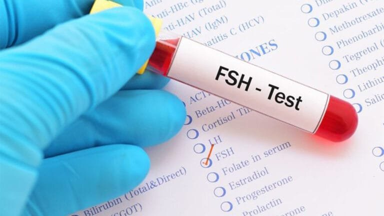 تحليل هرمون الخصوبة FSH - MEDEXA