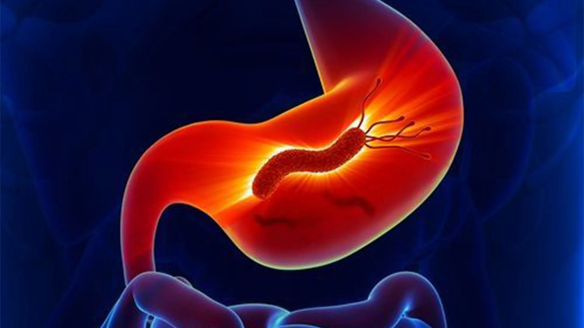 تحليل جرثومة المعدة في اسطنبول