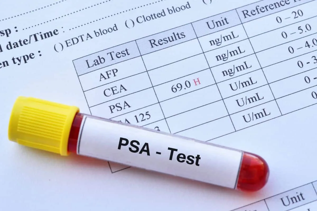 مخبر تحاليل طبية في إسطنبول يقوم بإجراء تحليل الدم PSA وفحوصات مخبرية دقيقة باستخدام أجهزة حديثة.