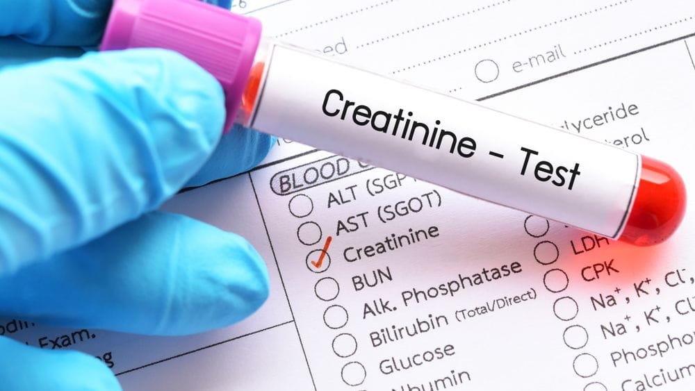 تحليل الكرياتينين في الدم داخل مخبر تحاليل طبية في إسطنبول لتقييم وظائف الكلى.