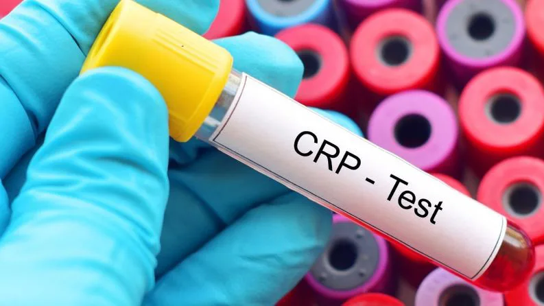 تحليل CRP في الدم داخل مخبر تحاليل طبية في إسطنبول للكشف عن الالتهابات الحادة والمزمنة.