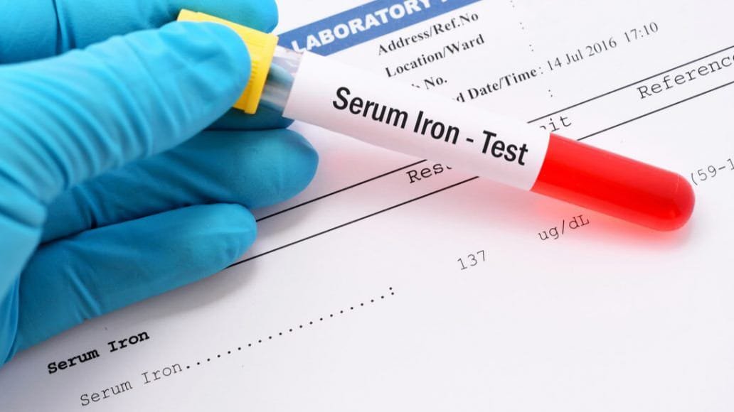 تحليل الحديد في الدم داخل مخبر تحاليل طبية في إسطنبول لتشخيص فقر الدم ونقص الحديد.