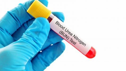 تحليل اليوريا في الدم داخل مخبر تحاليل طبية في إسطنبول لتقييم وظائف الكلى والجفاف.