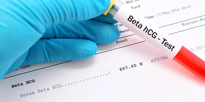 تحليل الحمل Beta hCG في إسطنبول للكشف المبكر عن الحمل عبر قياس هرمون الحمل في الدم.