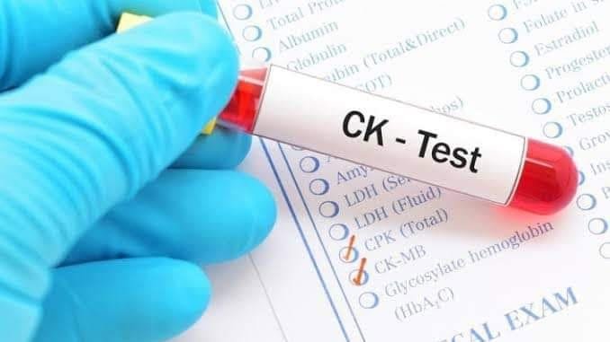 تحليل CK في إسطنبول لقياس إنزيم الكرياتين كيناز والكشف عن إصابات العضلات وأمراضها.