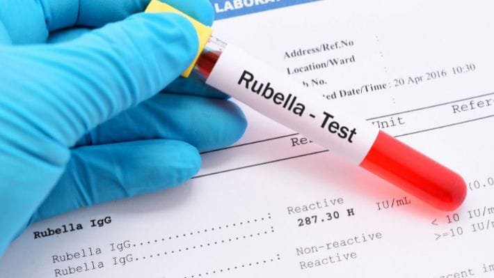 تحليل الحصبة الألمانية Rubella IgG وIgM في إسطنبول للكشف عن المناعة أو العدوى الحديثة بفيروس الحصبة الألمانية.