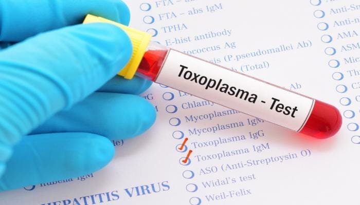 تحليل جرثومة القطة Toxoplasma IgG وIgM في إسطنبول للكشف عن الإصابة الحالية أو السابقة بداء المقوسات.