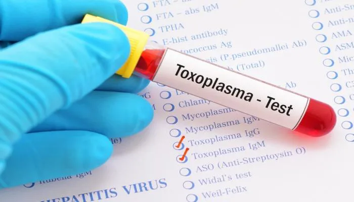 تحليل جرثومة القطة Toxoplasma IgG وIgM في إسطنبول للكشف عن الإصابة الحالية أو السابقة بداء المقوسات.